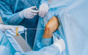 How Total Knee Replacement Can Transform Your Life