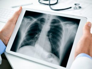 Advanced X-Ray