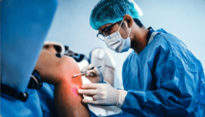 Knee Arthroscopy: A Minimally Invasive Joint Solution